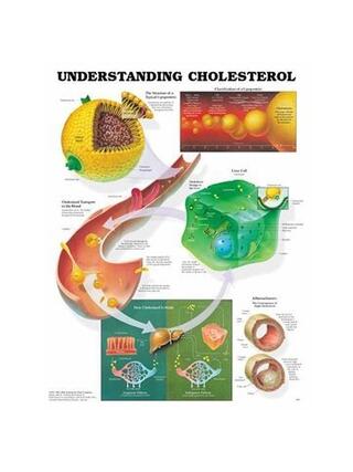 Laminovaný plagát s názvom Pochopenie cholesterolu 51x66 cm
