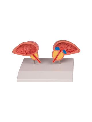 Model prostaty, 2-dielny
