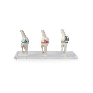 Model kolenného implantátu