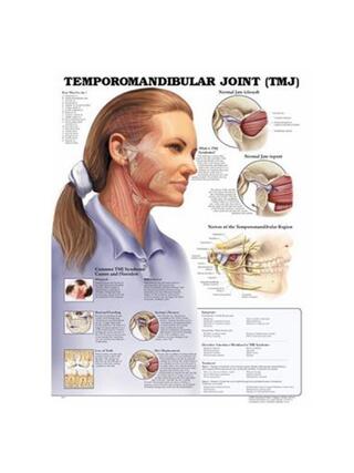 Porucha temporomandibulárneho kĺbu (TMJ) laminovaná angličtina